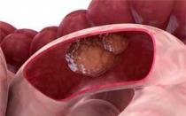 Histologia intestinal do intestino grosso