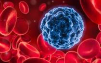 Jakie badania należy wykonać, aby sprawdzić organizm pod kątem nowotworu i markerów nowotworowych?