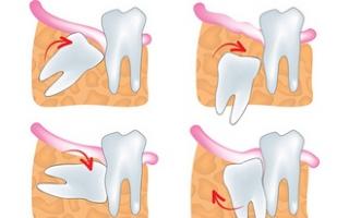 Algoritmus na vykonávanie praktickej zručnosti „Operácie na konzervovanie zubov Operácie na konzervovanie zubov v zubnom lekárstve