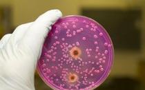 Domowy test na obecność grzyba Candida w organizmie i sposoby leczenia zaburzeń równowagi