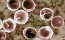 Pozitīvs Antichlamydia Trachomatis IGG tests