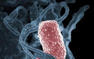 Klebsiella pneumoniae bakteriofag dimurnikan Tindakan pencegahan untuk digunakan