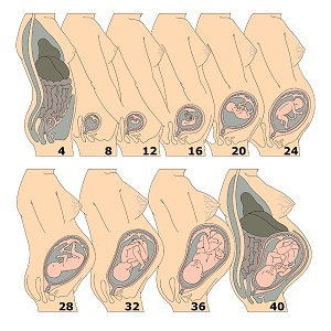 Растяжение матки во время беременности